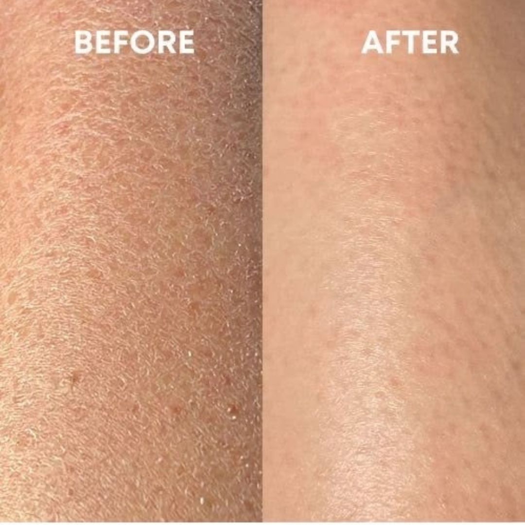 Veet Gel Sensitive – Elimina el Vello en 5 Minutos